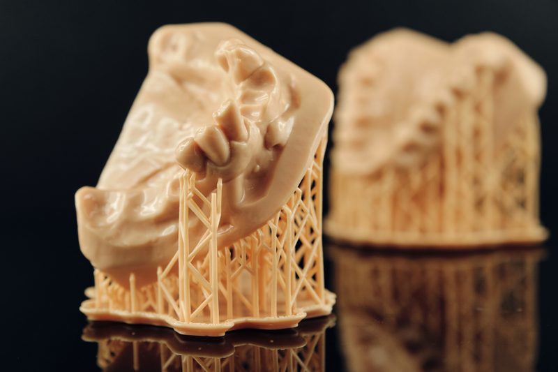 Full denture 3D printed — digital workflow dental lab